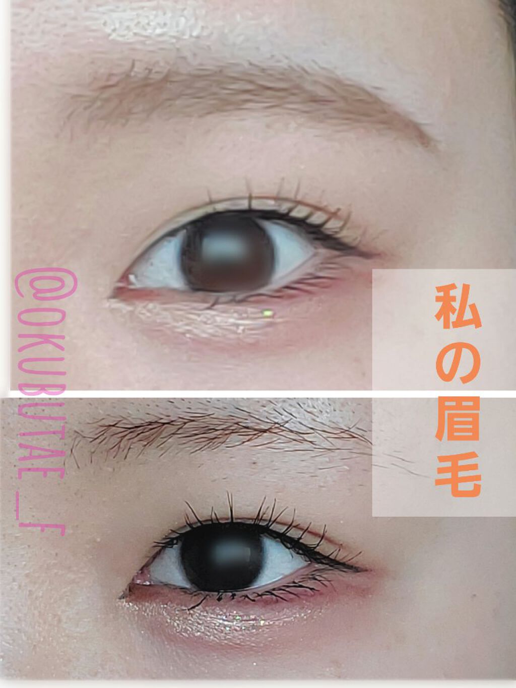 脱色クリーム 敏感肌用/エピラット/ムダ毛ケアを使ったクチコミ（1枚目）