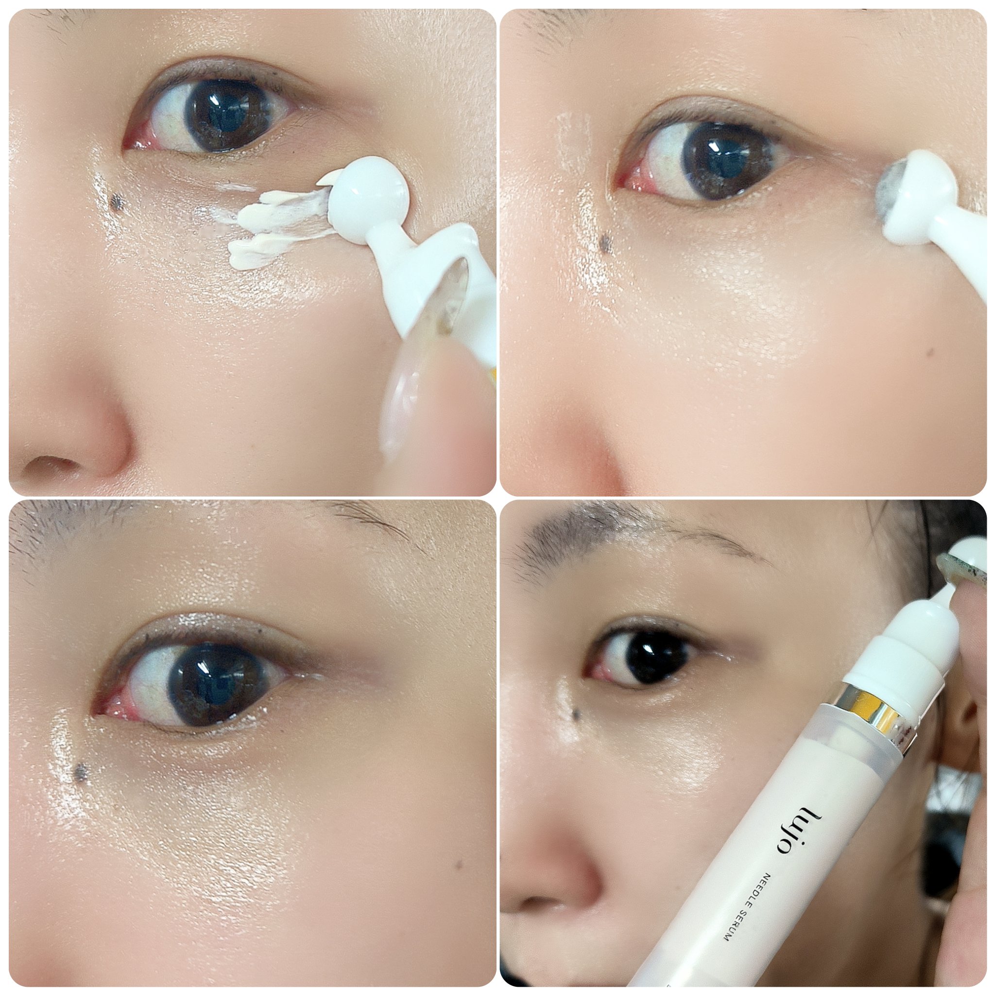 lujo ニードルセラムブライト｜lujoの使い方を徹底解説 - 針を