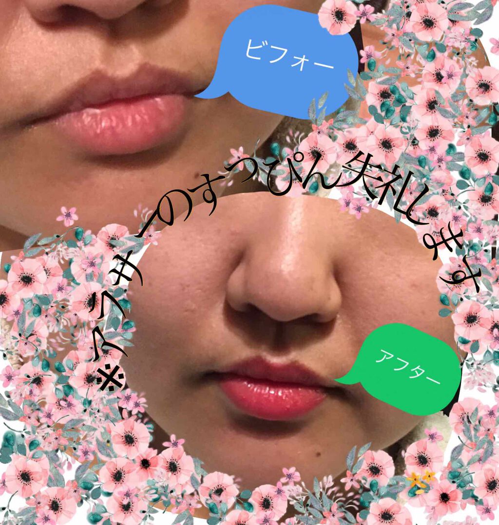 ブライトアップルージュ/media/口紅を使ったクチコミ（3枚目）