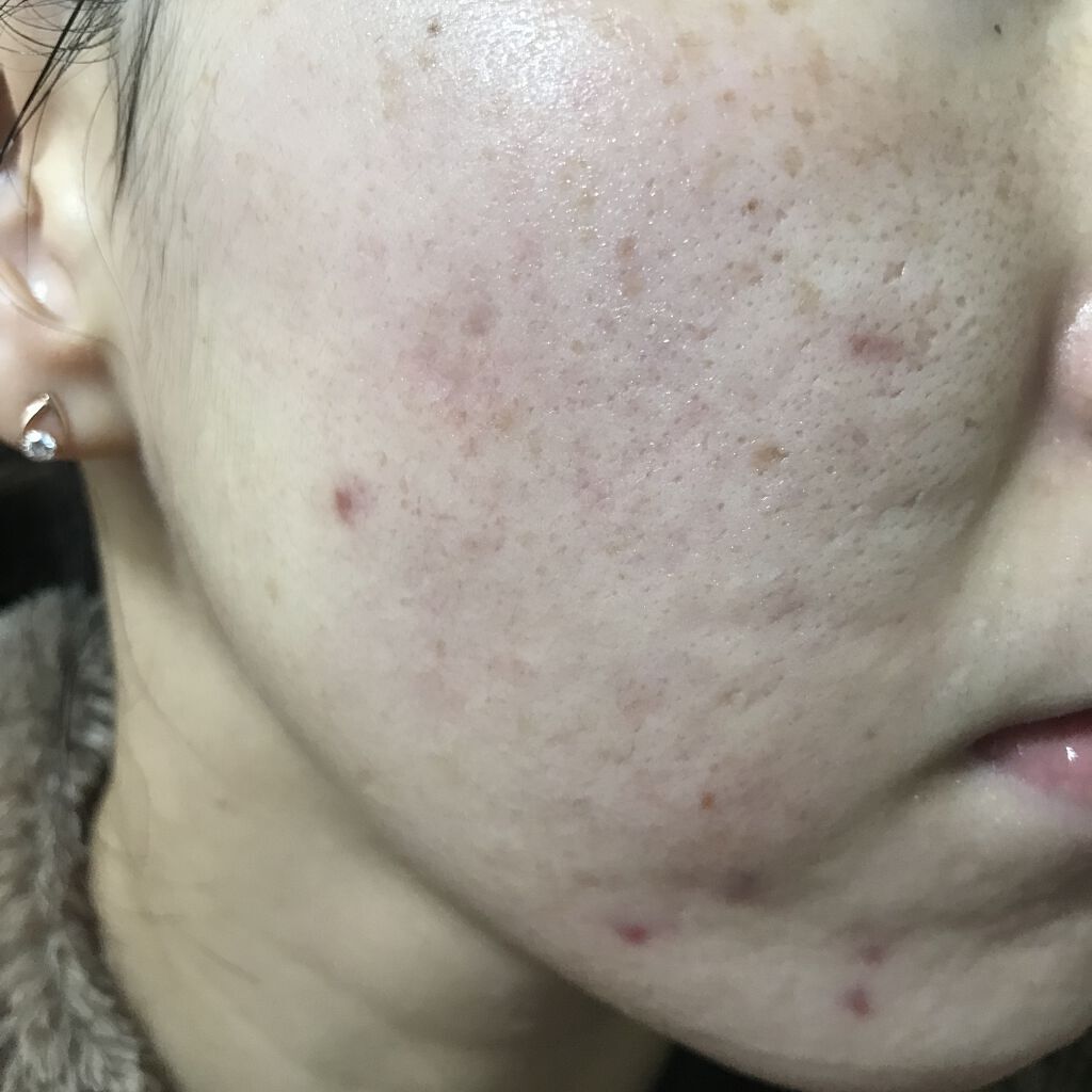 SERENDI BEAUTY PERFECT AIRY COVER CUSHIONのクチコミ「12/13の肌記録！

👀この3日間
なぜが寝つきが悪いし目が覚めるし

なんでだろ〜？？？っ.....」（1枚目）