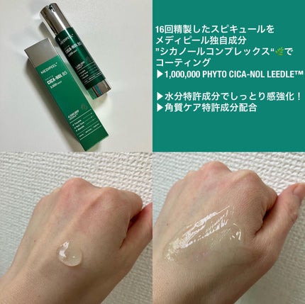フィトシカノールB5 3000ショットセラム/MEDIPEEL/美容液を使ったクチコミ(2枚目)