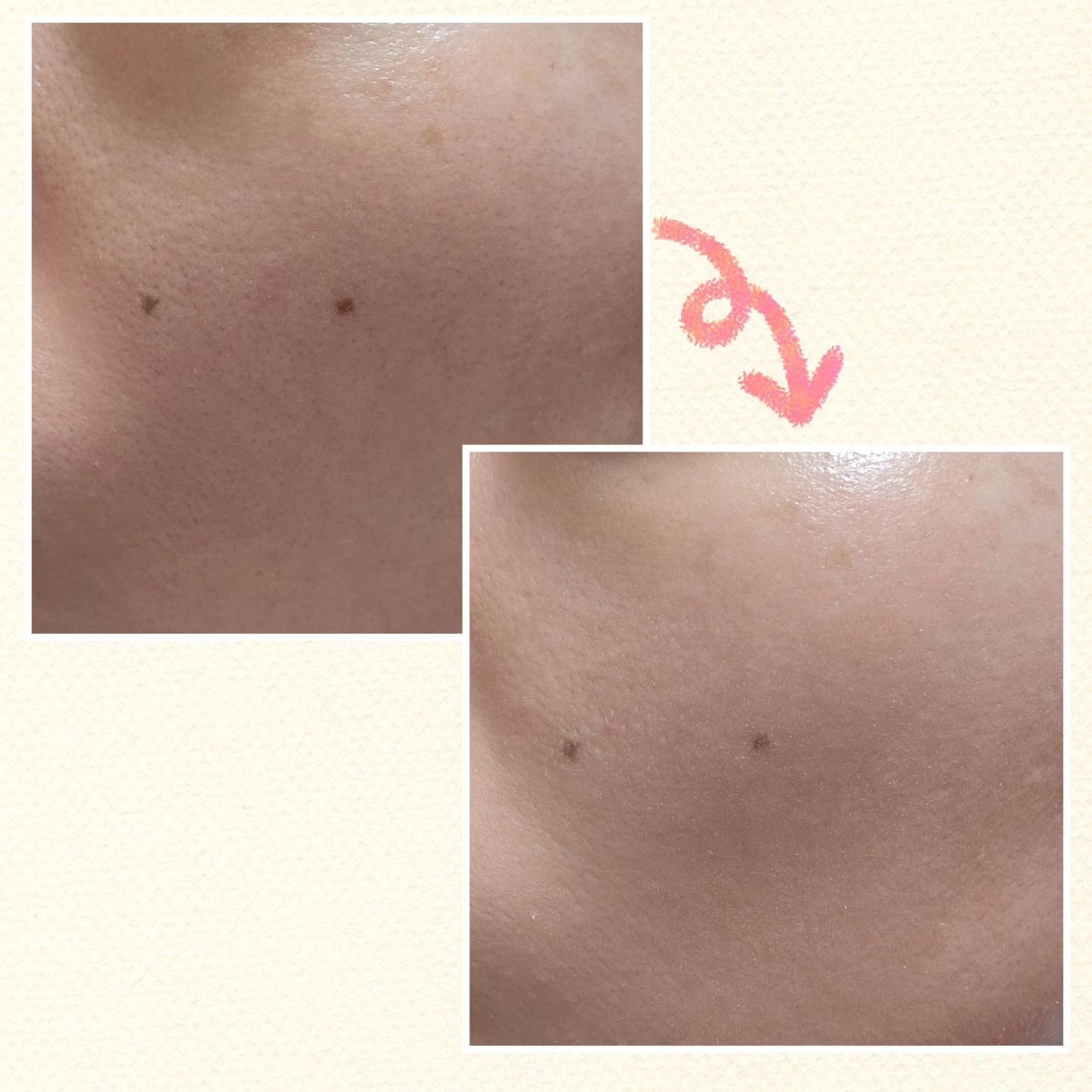 薬用クリアエステヴェールEX/Macchia Label/リキッドファンデーションを使ったクチコミ(2枚目)