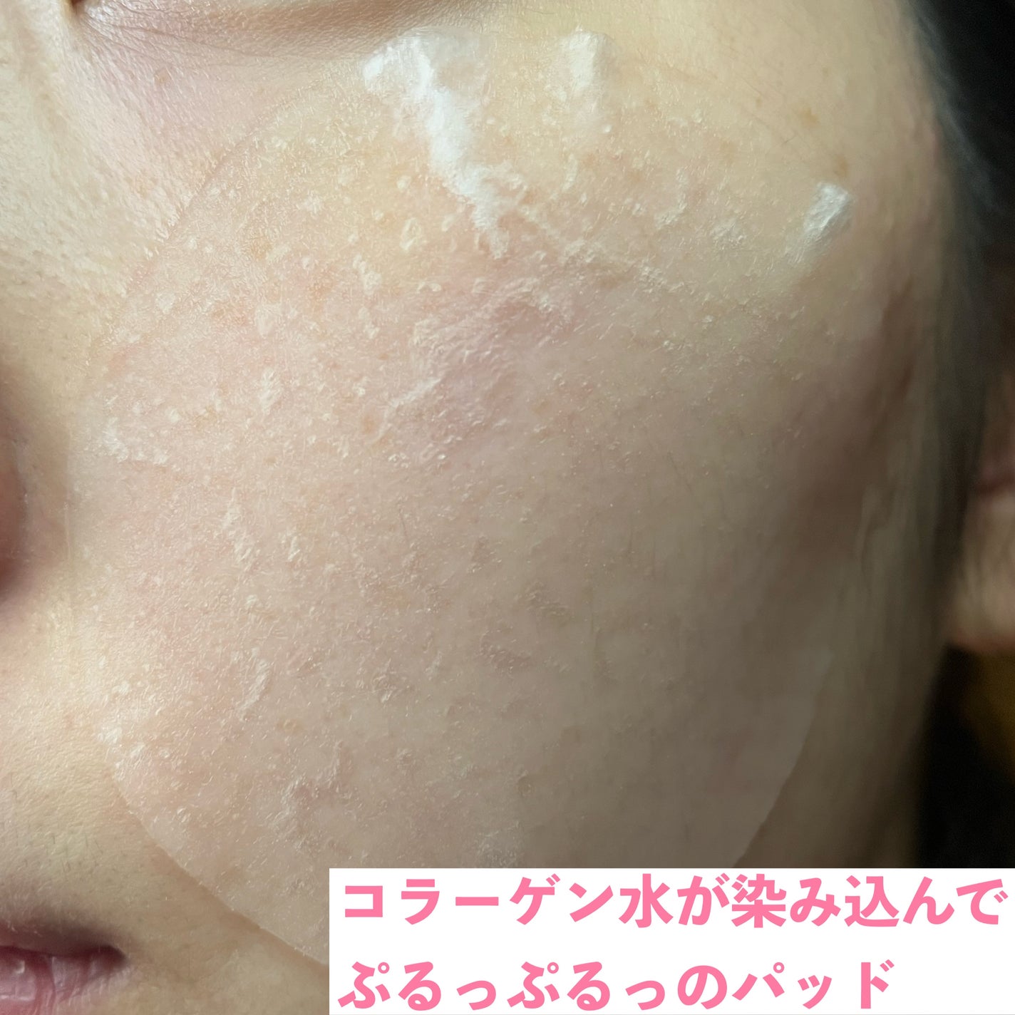 コラーゲンゲルトナーパッド/Biodance/トナーパッドを使ったクチコミ(3枚目)