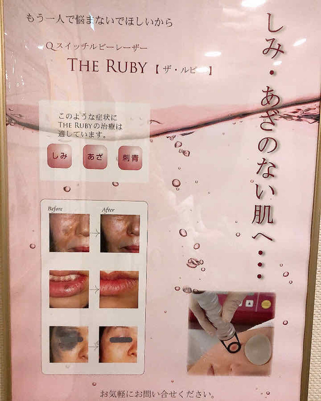 報告/その他を使ったクチコミ（2枚目）