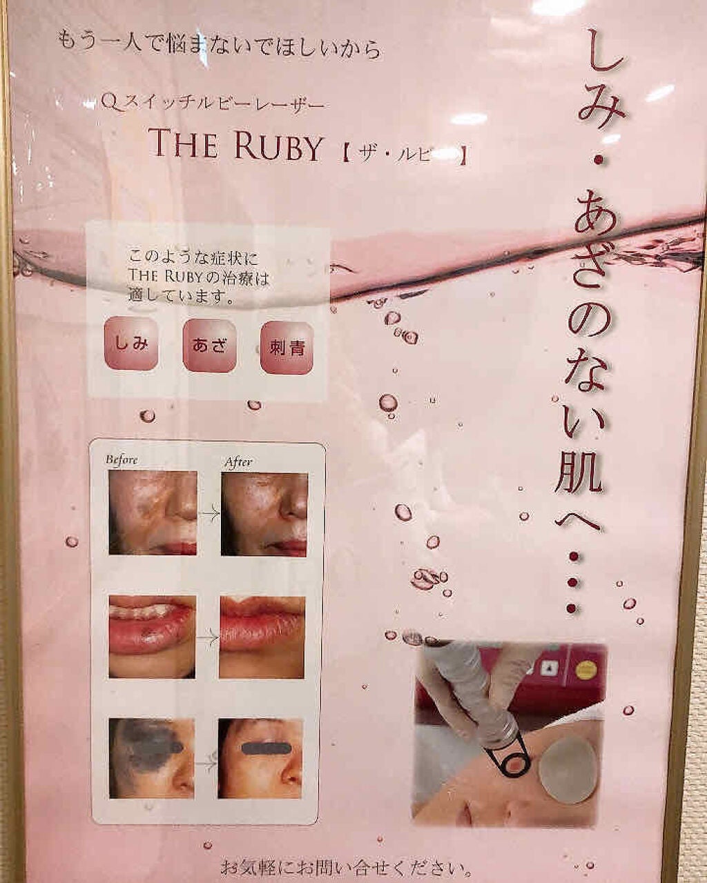 たらちゃん☆follow back100 on LIPS 「撮る環境が違ったため、写真の色合いが伝わりにくくてすいません…..」(2枚目)