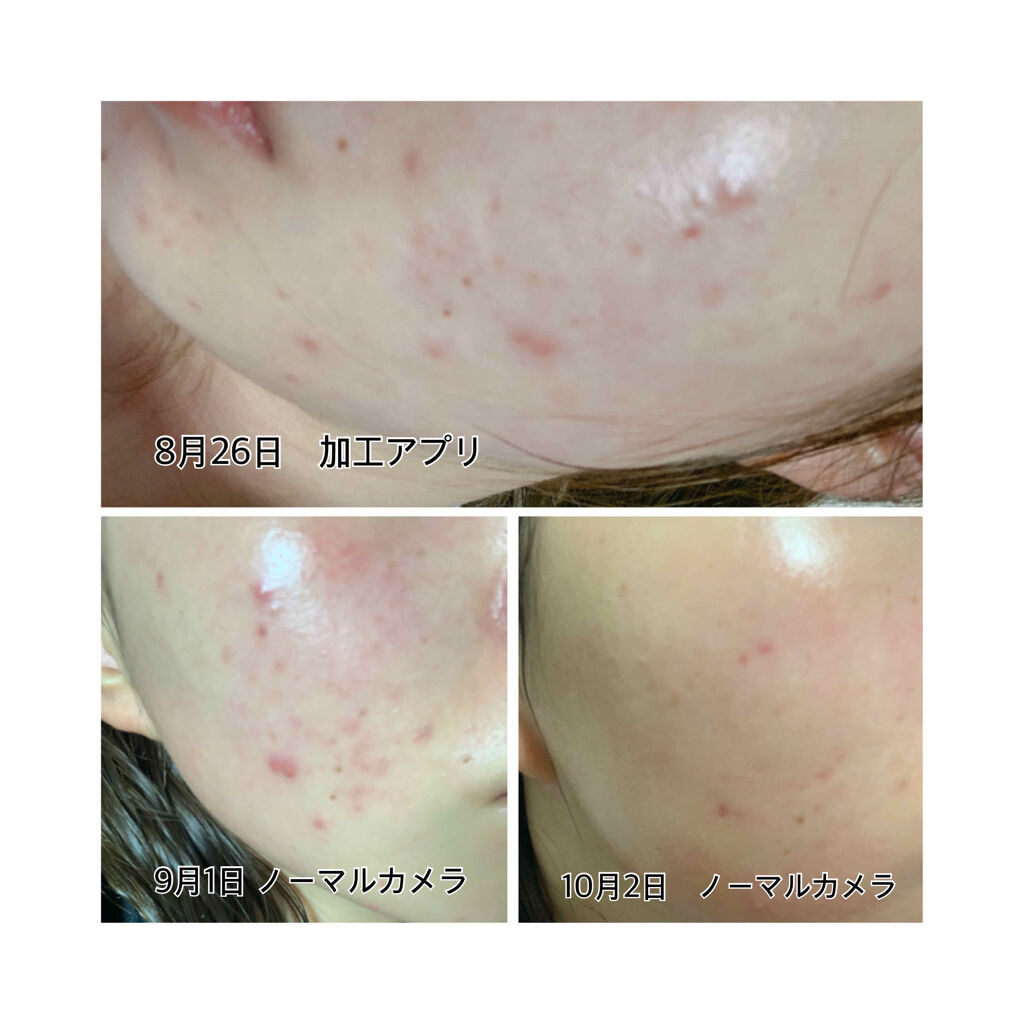 ハトムギ化粧水(ナチュリエ スキンコンディショナー R )/ナチュリエ/化粧水を使ったクチコミ（1枚目）