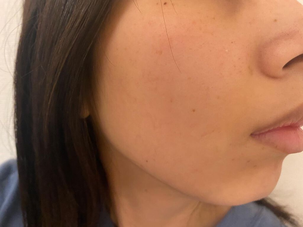 UVイデア XL プロテクショントーンアップ/ラ ロッシュ ポゼ/日焼け止めクリームを使ったクチコミ(2枚目)