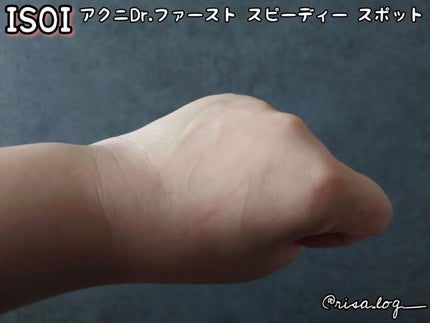 アクニドクターファーストスピーディースポット/ISOI/美容液を使ったクチコミ(4枚目)