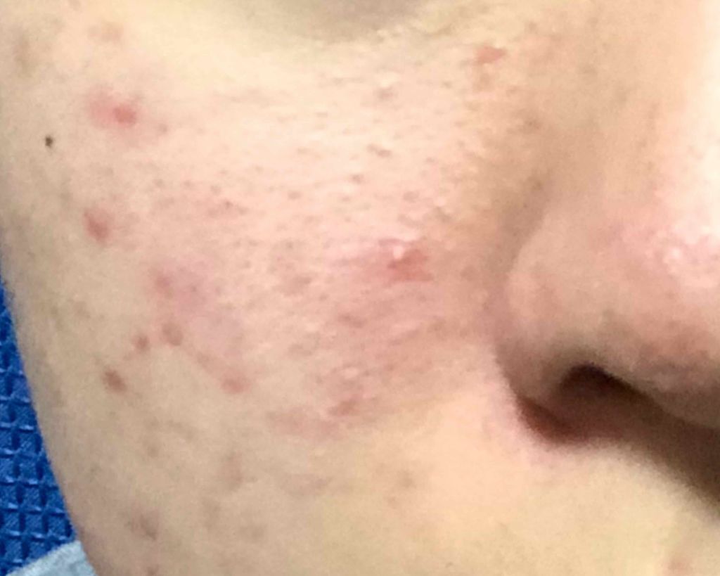 ハトムギ保湿ジェル(ナチュリエ スキンコンディショニングジェル)/ナチュリエ/美容液を使ったクチコミ（2枚目）