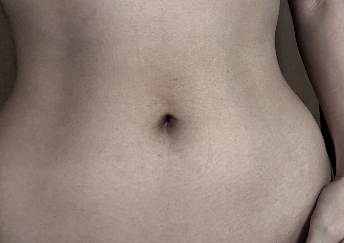 防風通聖散 ボウフウツウショウサン(医薬品)/ツムラ/その他を使ったクチコミ（2枚目）