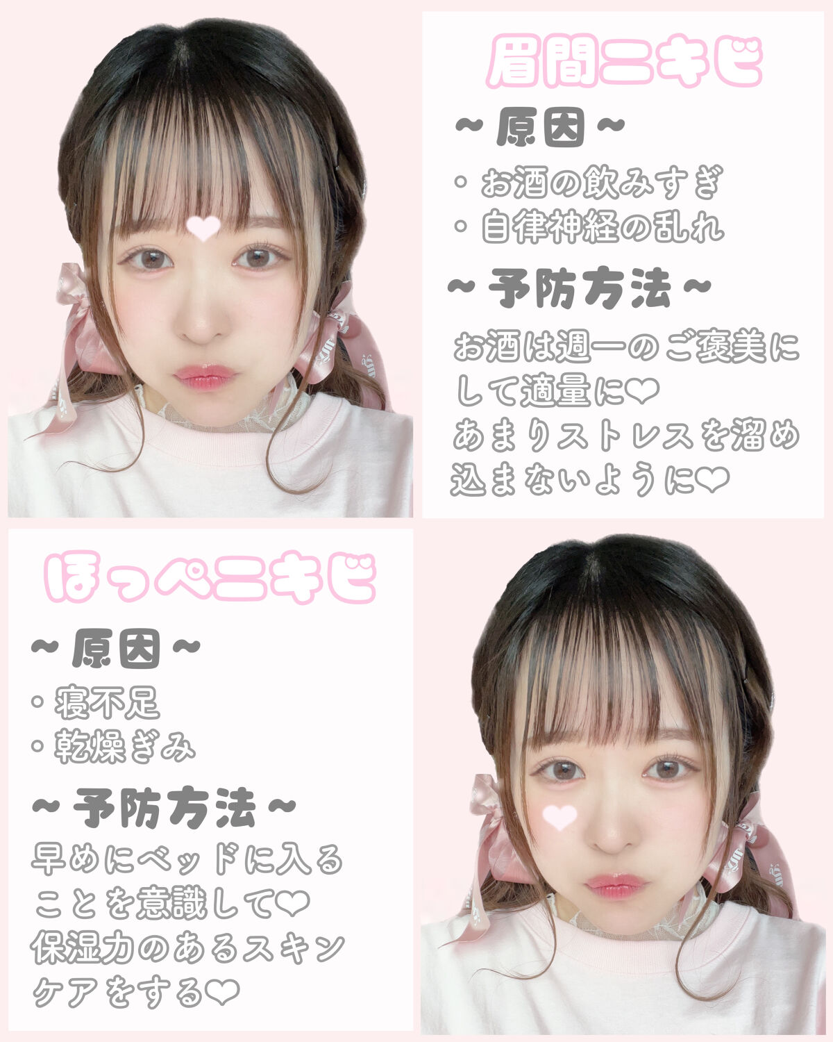 ごめんね素肌 キニナルマスク/クリアターン/シートマスク・パックを使ったクチコミ（3枚目）