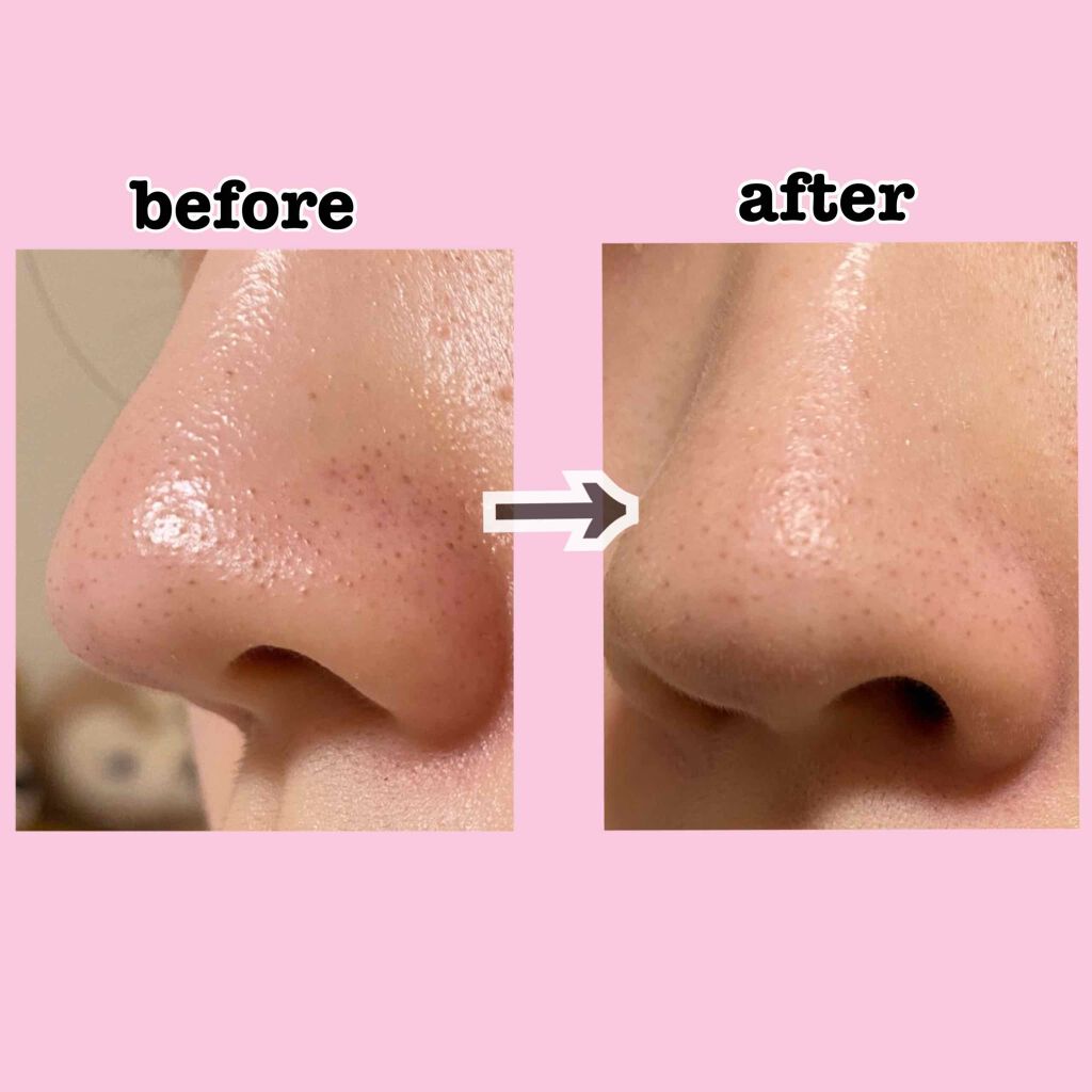 ファストスキンメーカー N/インテグレート/化粧下地を使ったクチコミ(3枚目)