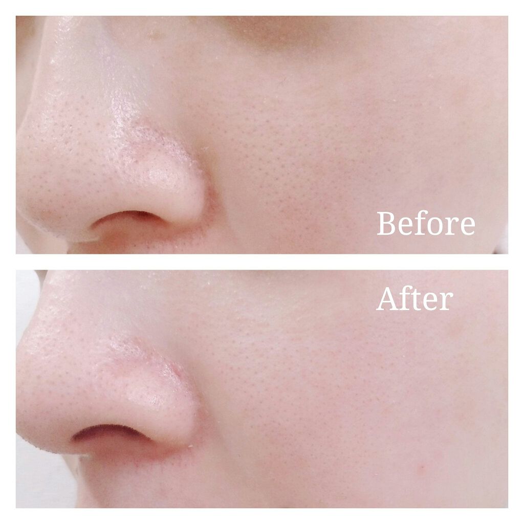 マンデリック インテンシブ 18%セラム/DR.WU/美容液を使ったクチコミ(3枚目)