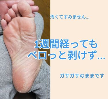 足裏角質パック ティアラローズの香り Everyyouの辛口レビュー 注意 ４枚目足の汚い写真あります ドンキで By Lily 脂性肌 30代前半 Lips