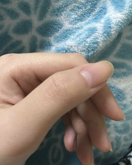 エテュセ クイックケアコート/ettusais/ネイルオイル・トリートメントを使ったクチコミ(2枚目)