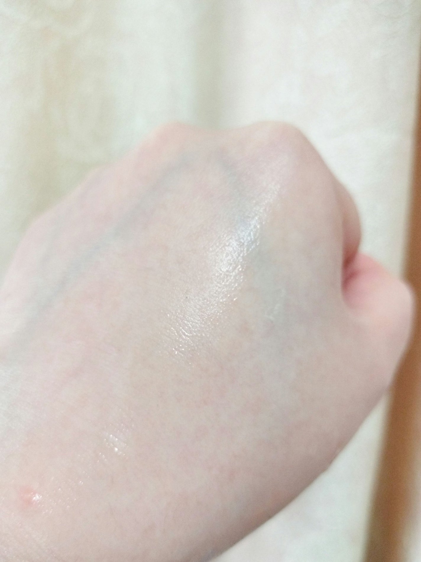 バーチシカカーミングトナー/RAVIEL/化粧水を使ったクチコミ(7枚目)