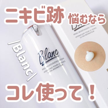 ブラン マジックカタツムリクリームのクチコミ「【ニキビ跡ケア】【Blanc】

＼肌トラブル･跡を徹底ケア🤍‎ ̖́-  ／
ニキビ跡で悩ん.....」（1枚目）