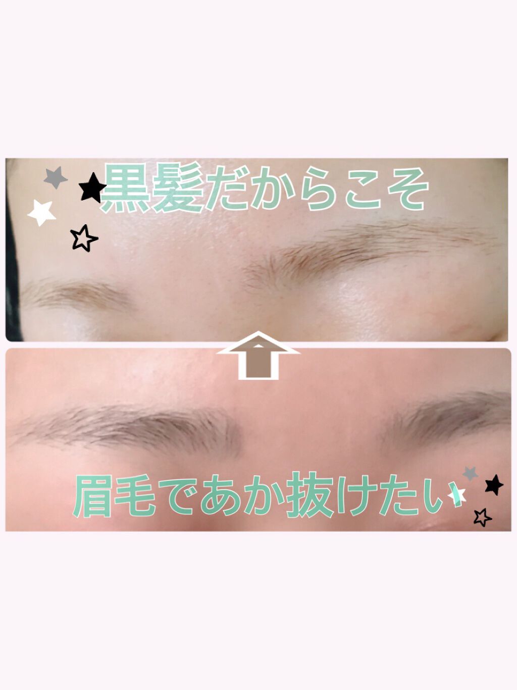 脱色クリーム 敏感肌用/エピラット/ムダ毛ケアを使ったクチコミ（1枚目）