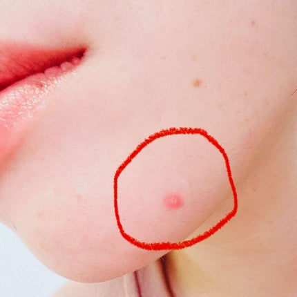 ごめんね素肌 キニナルマスク/クリアターン/シートマスク・パックを使ったクチコミ(4枚目)