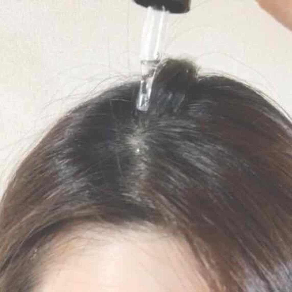 スカルプケアエッセンス/LINNA/頭皮ローションを使ったクチコミ(4枚目)