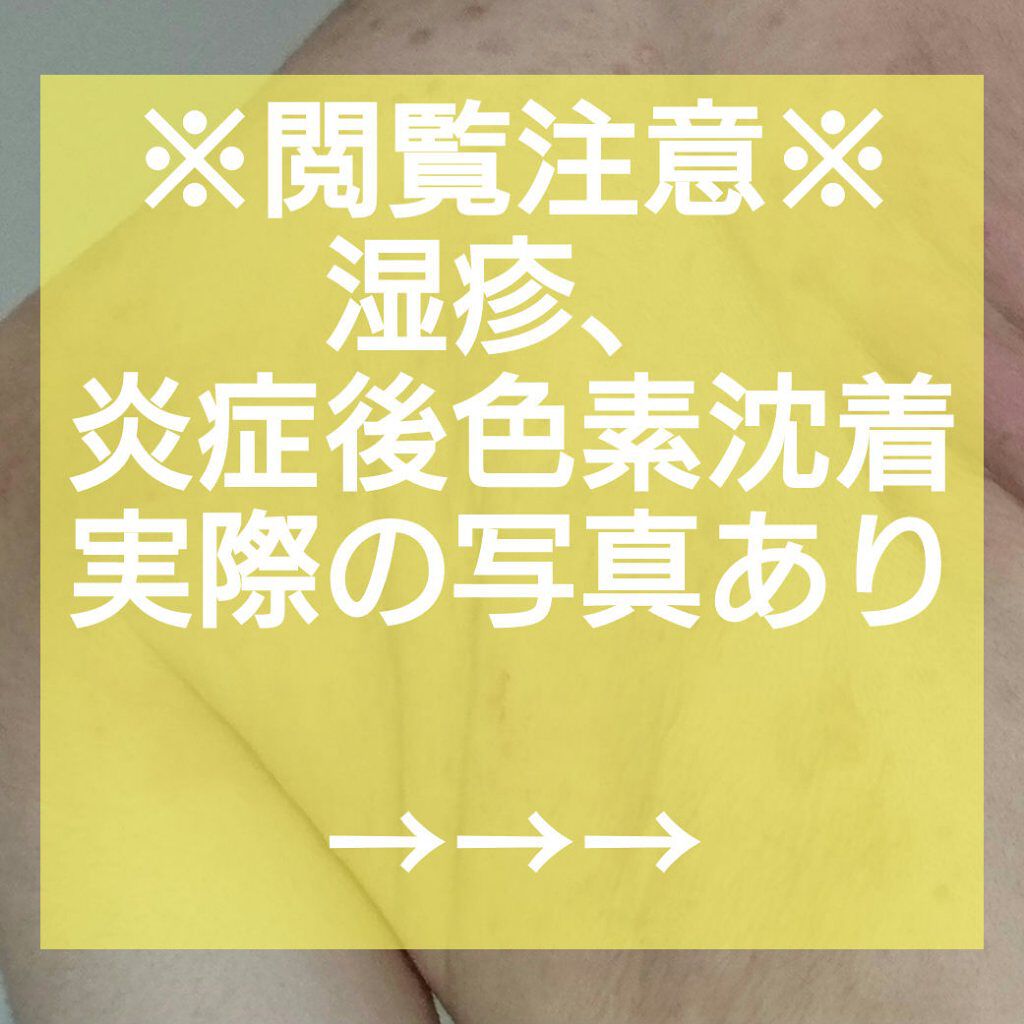 メンソレータムADクリームm(医薬品)/メンソレータムAD/その他を使ったクチコミ（1枚目）