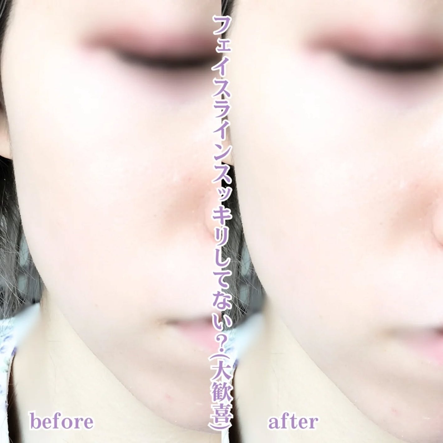 リフト美顔器/ANLAN/美顔器・マッサージを使ったクチコミ(6枚目)