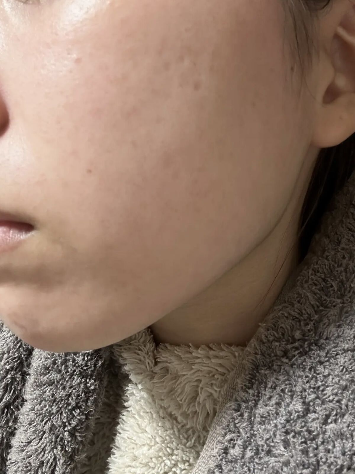 DRX AZAクリア/ロート製薬/その他スキンケアを使ったクチコミ（3枚目）