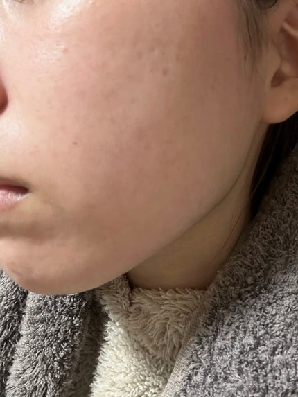 グーダル グリーンタンジェリンビタCセラムマスク/goodal/シートマスク・パックを使ったクチコミ(3枚目)