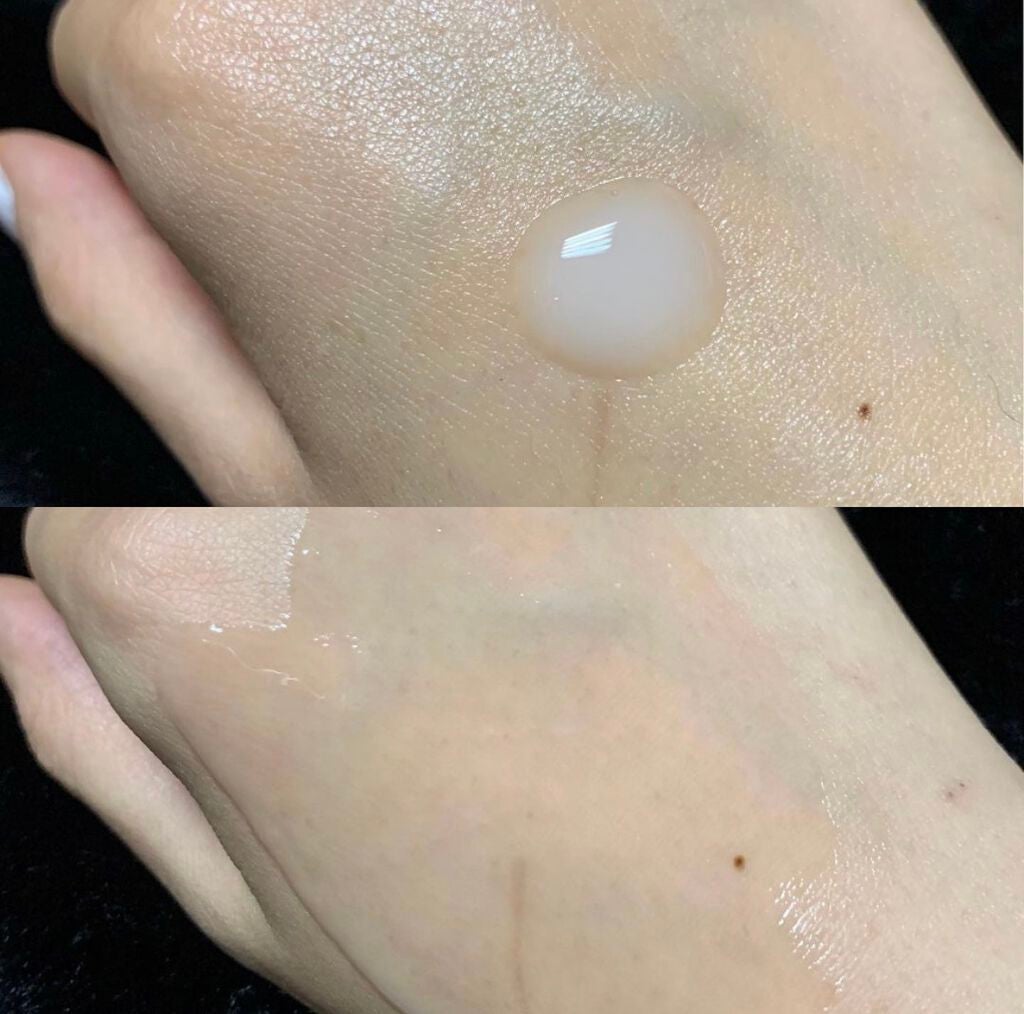 リズムコンセントレートα/AYURA/美容液を使ったクチコミ(2枚目)