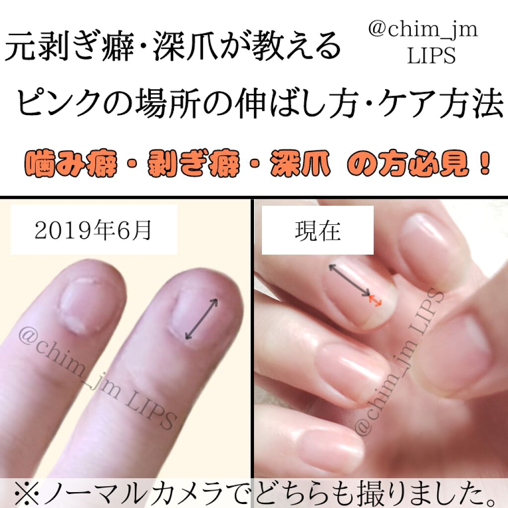 ネイルケア・オイル/ドクター・ショール/ネイルオイル・トリートメントを使ったクチコミ（1枚目）