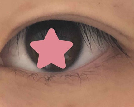 アイビューティー フィクサー WP/アストレア ヴィルゴ/二重まぶた用アイテムを使ったクチコミ(2枚目)