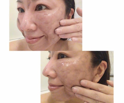 ブラックジェルクレンジング/.akaran/クレンジングジェルを使ったクチコミ(4枚目)