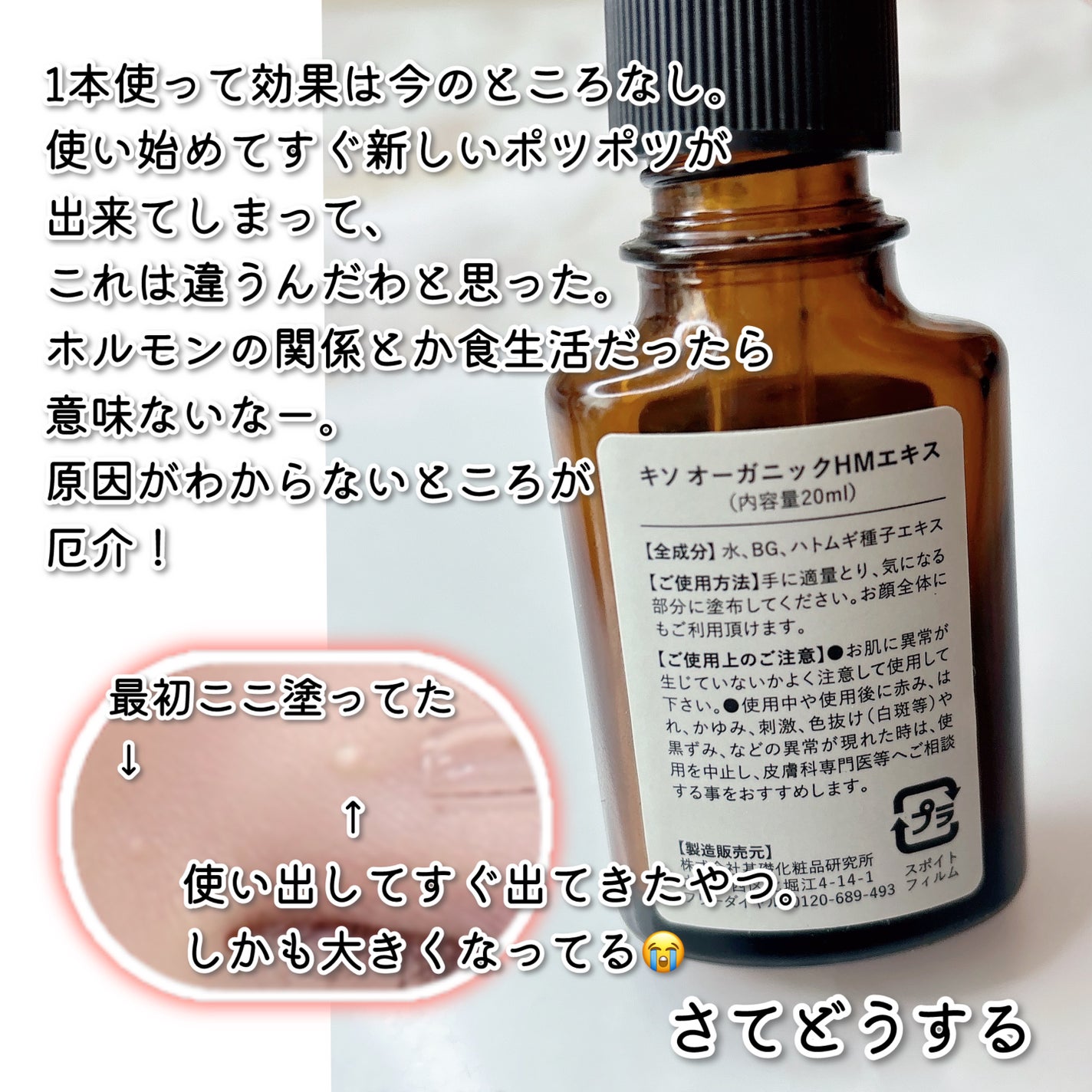 オーガニック ハトムギエキス (ヨクイニン)/KISO/その他を使ったクチコミ(3枚目)