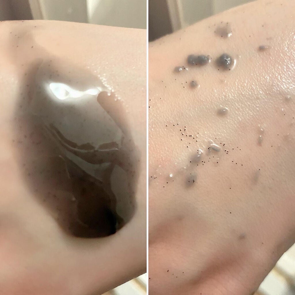 DETクリア ブライト&ピール ピーリングジェリー<無香料タイプ>/Detclear/ピーリングを使ったクチコミ(3枚目)