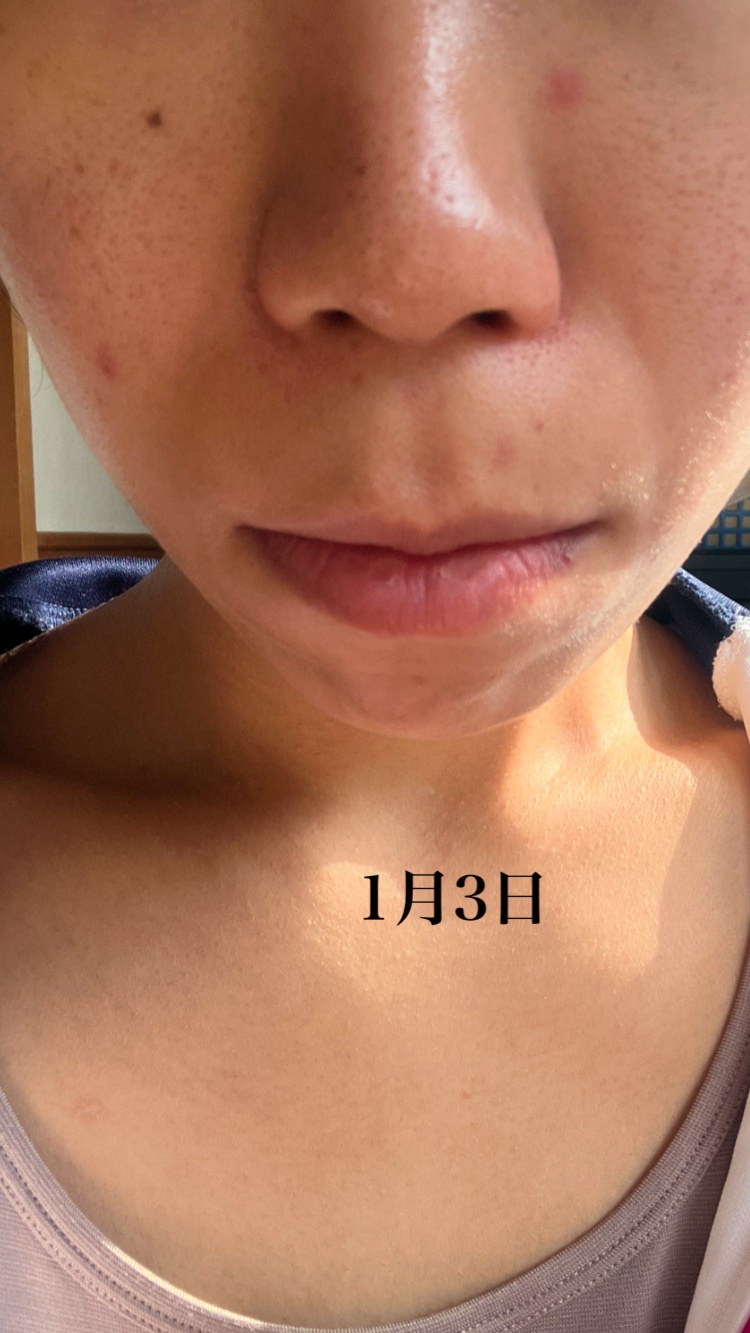 を使ったクチコミ（3枚目）