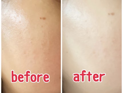 ナインセラム/Dr.Twenty Project/美容液を使ったクチコミ(5枚目)