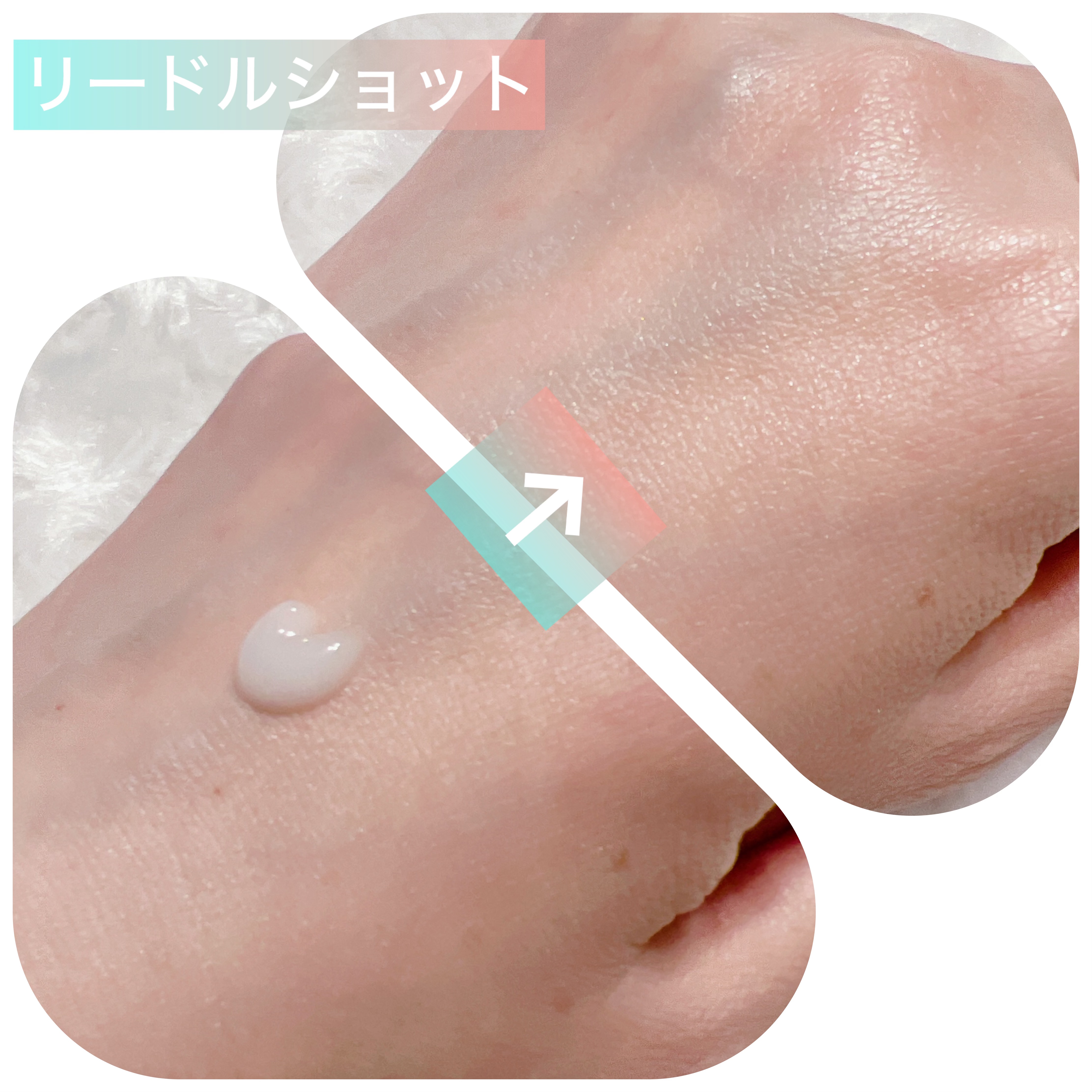 リードルショット100/VT/美容液を使ったクチコミ（2枚目）