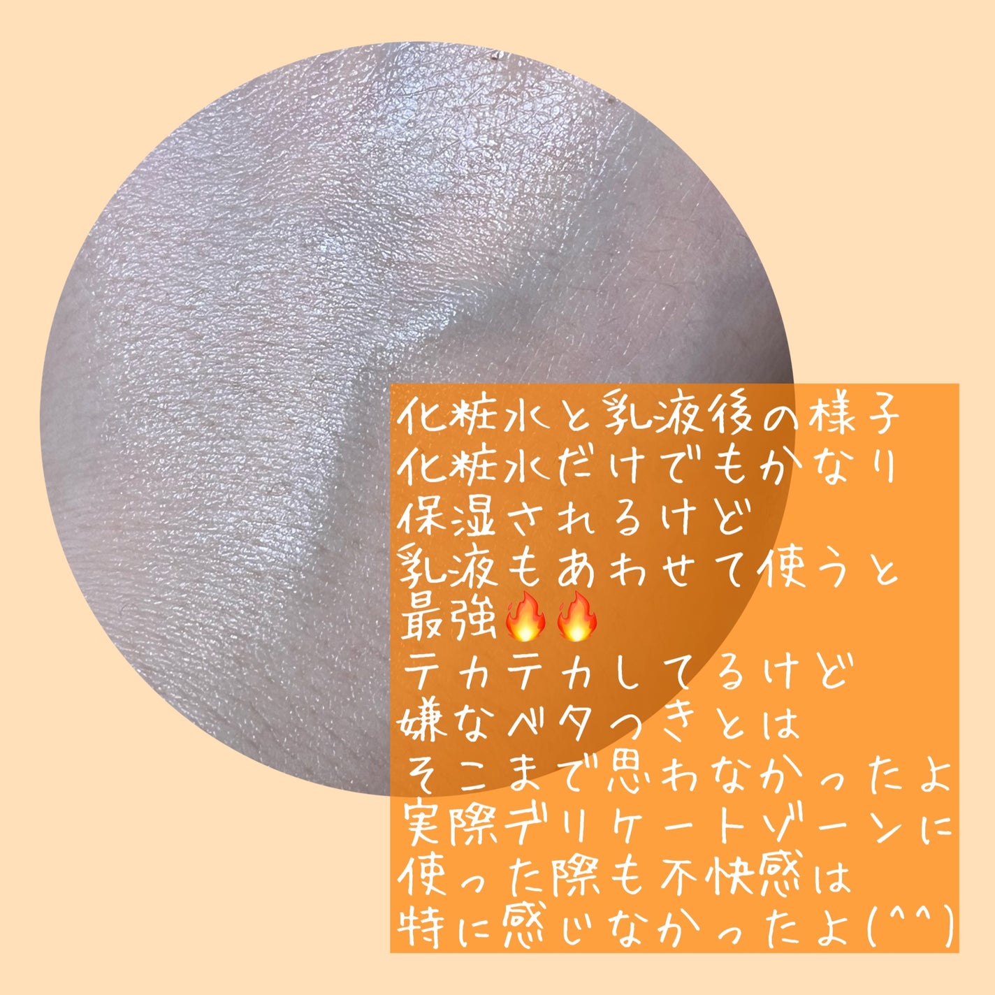 VIO TREATMENT LOTION/iroha INTIMATE CARE/デリケートゾーンケアを使ったクチコミ(3枚目)