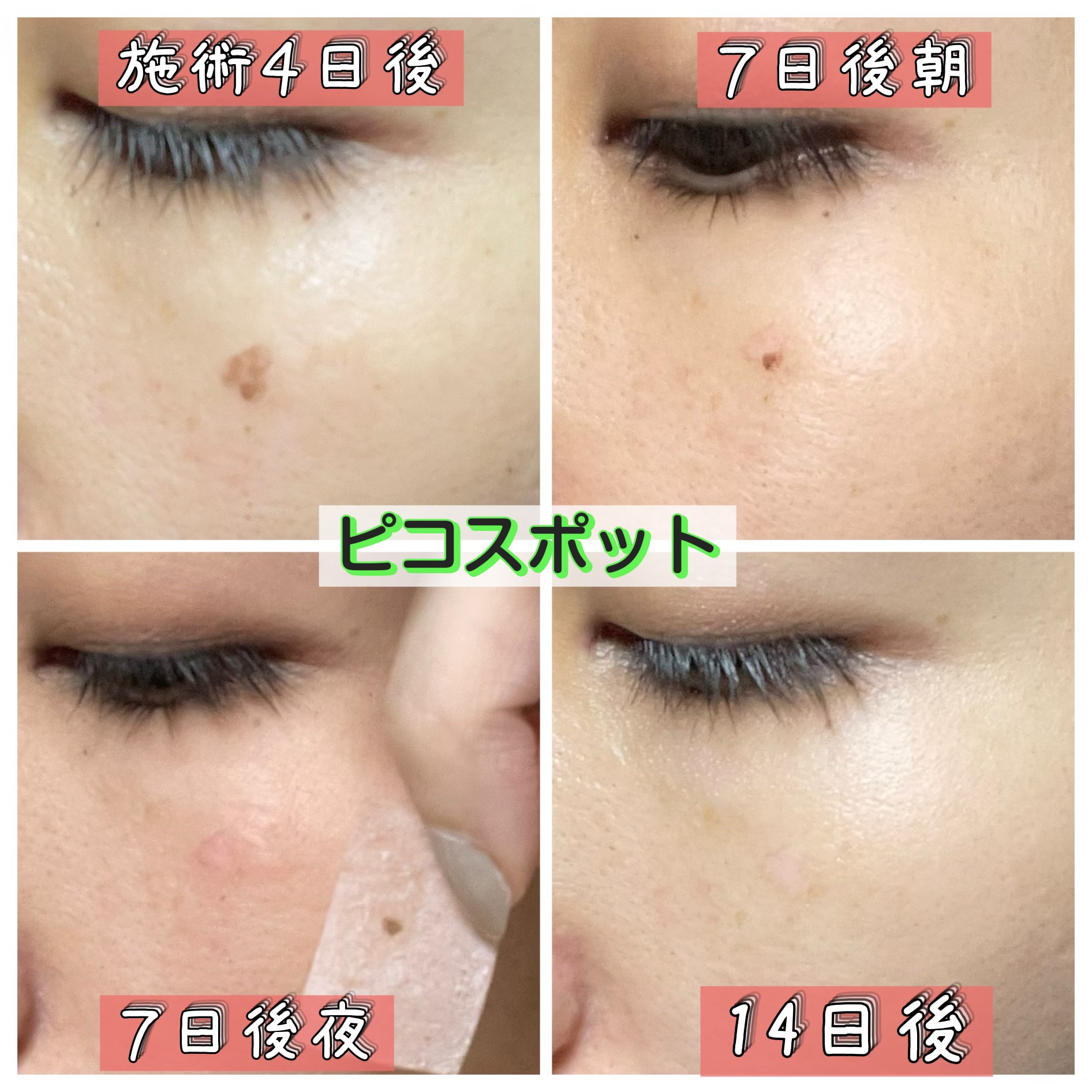 バイオ コンディショニング エッセンス/IOPE/ブースター・導入液を使ったクチコミ（3枚目）