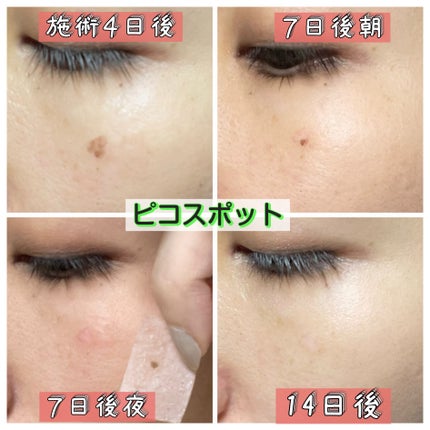 ベネフィーク セラム/BENEFIQUE/美容液を使ったクチコミ(3枚目)