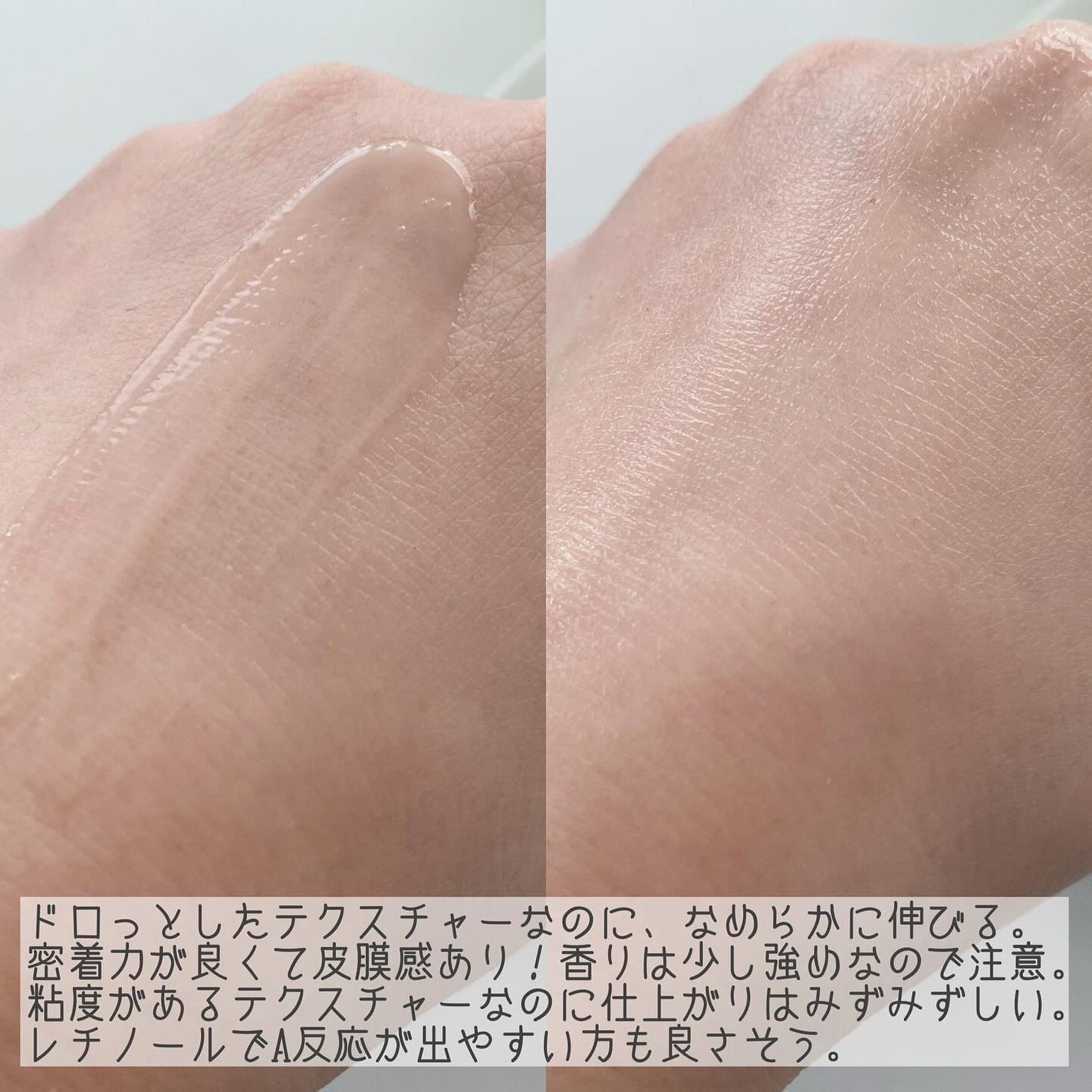 ブラックスネイルレチノールセラム/Dr.G/美容液を使ったクチコミ(5枚目)