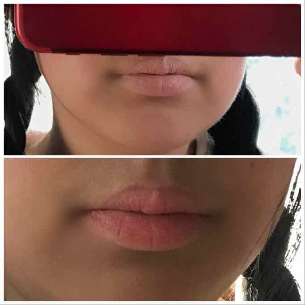 パーフェクトリップコンシーラー/COSCOS/クリームコンシーラーを使ったクチコミ(4枚目)