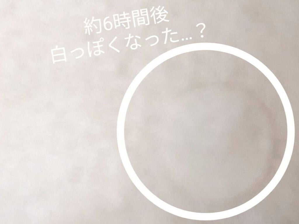 アクネピンプルマスターパッチ /COSRX/にきびパッチを使ったクチコミ(5枚目)