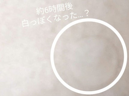 アクネピンプルマスターパッチ /COSRX/にきびパッチを使ったクチコミ(5枚目)