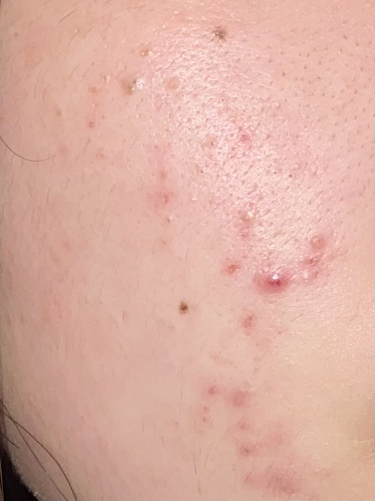 乳液・敏感肌用・しっとりタイプ/無印良品/乳液を使ったクチコミ（1枚目）