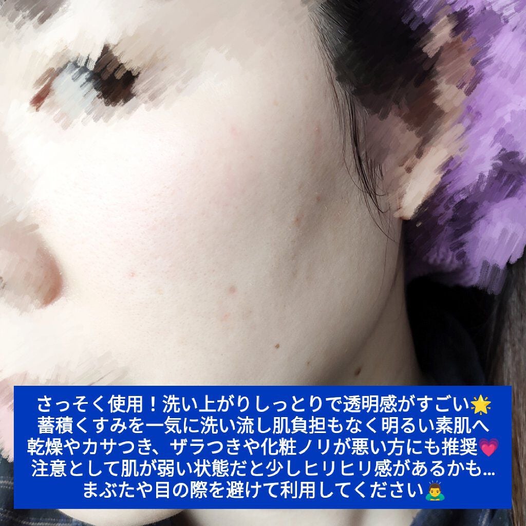 ソフィーナ iP リニュー ムース ウォッシュ/SOFINA iP/洗顔フォームを使ったクチコミ(3枚目)