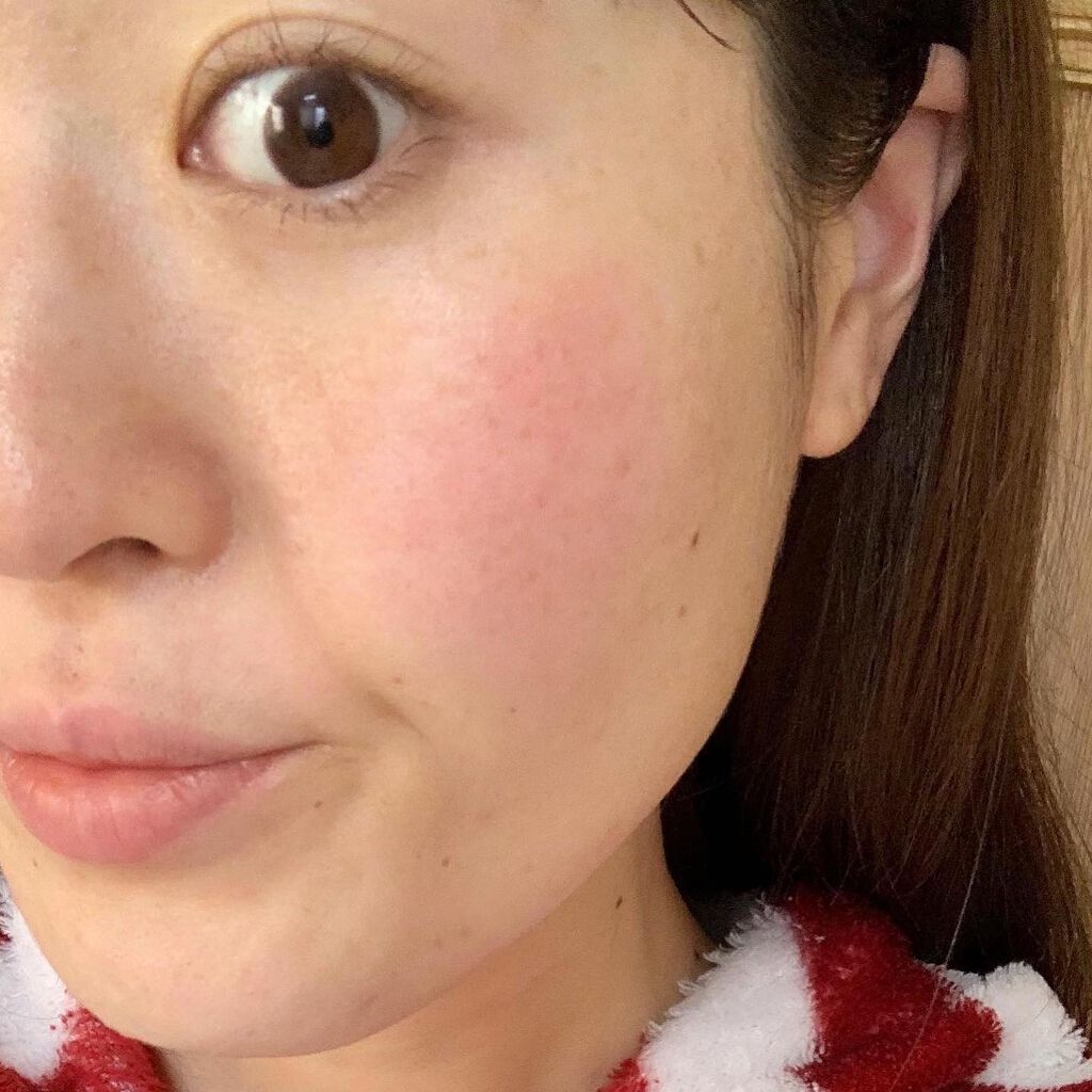 HSCセラム/ヘルスビューティー/美容液を使ったクチコミ(3枚目)