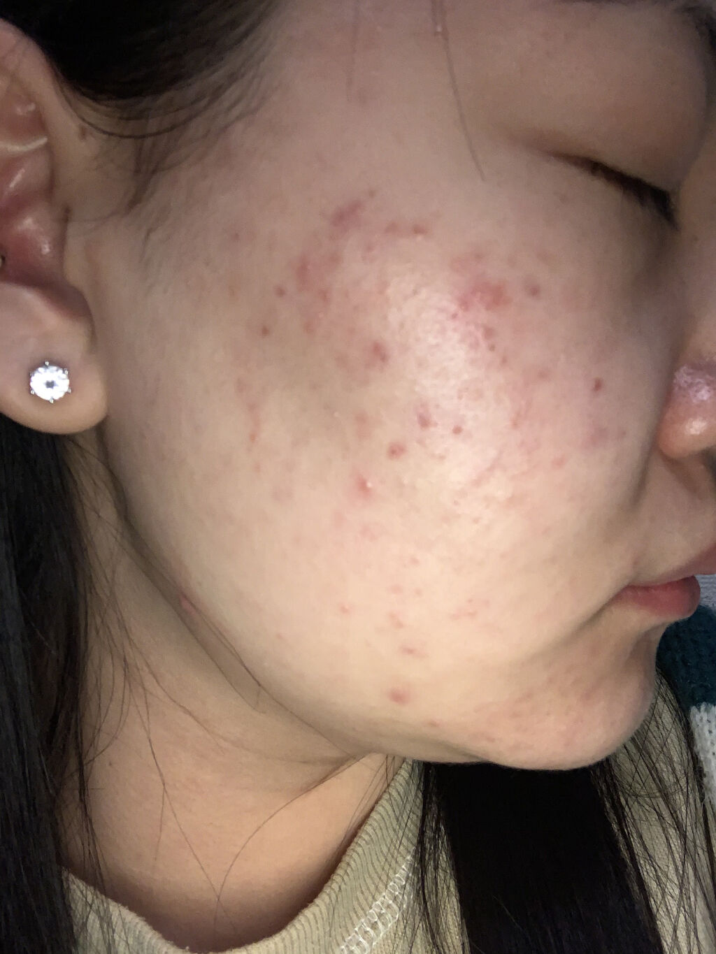 ティーツリーケア ソリューション エッセンシャルマスクEX/MEDIHEAL/シートマスク・パックを使ったクチコミ（3枚目）