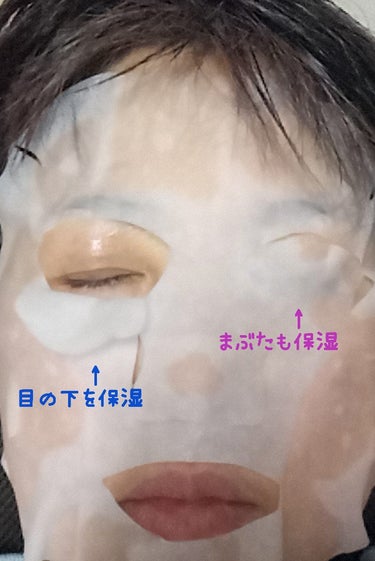 薬用 シワ改善 美容液マスク/クリアターン/シートマスク・パックを使ったクチコミ（6枚目）