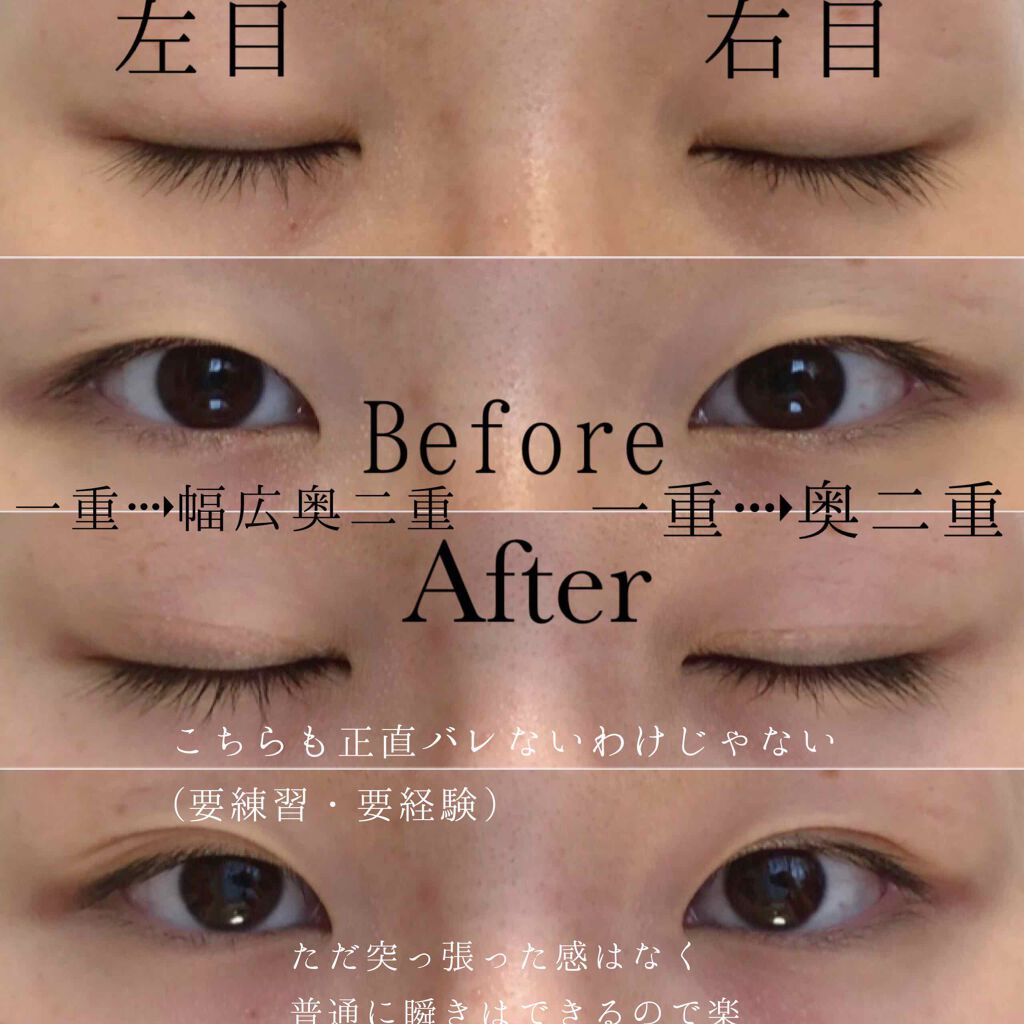 フリーファイバー120 スタンダードタイプ /メザイク/二重まぶた用アイテムを使ったクチコミ(8枚目)